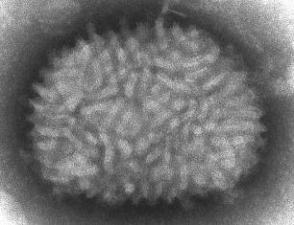 ԱՀԿ–ն զգուշացնում է. հայտնվել է նոր անհայտ մահացու վիրուս