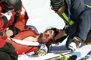 Չեխ լեռնադահուկորդը ծանր վնասվածքներ է ստացել 2015թ. ԱԱ–ում