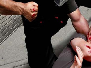 Հարվածներ է հասցրել մարմնի տարբեր մասերին՝ պատճառելով վնասվածքներ