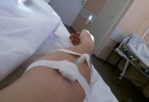 Այրվածքներ ստացածների առողջական վիճակում առկա է դրական տեղաշարժ