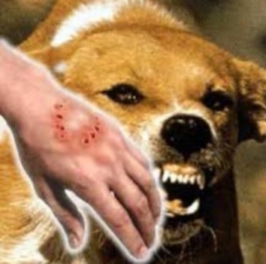 Այսօր Կատաղության դեմ պայքարի համաշխարհային օրն է