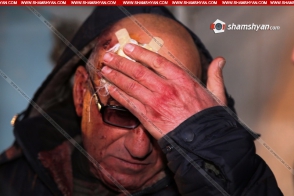 Ավազակային հարձակում Հրազդան քաղաքում. հարձակվել են տարադրամի փոխանակման կետի աշխատակցի վրա