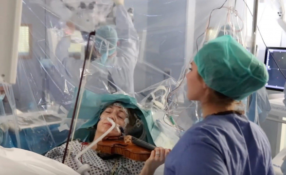 Կինը ջութակ է նվագում՝ ուղեղի վիրահատության ժամանակ