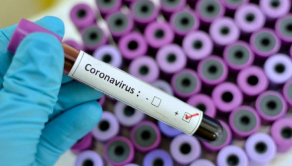 Կորոնավիրուսի հաստատված 136 դեպքից 112-ը փոխկապակցված են Էջմիածնի և արտադրամասի դեպքերի հետ