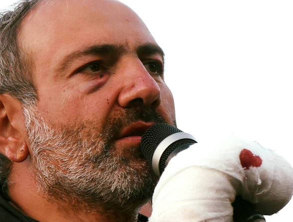 24 ժամվա ընթացքում 5000 իրական օգտատեր դիսլայք է արել Նիկոլ Փաշինյանի էջը (լուսանկար)