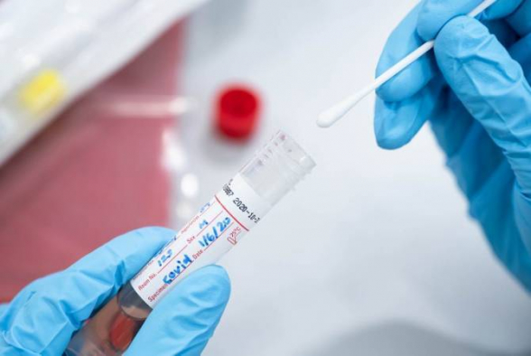 В Арцахе выявлены 10 случаев заражения коронавирусом