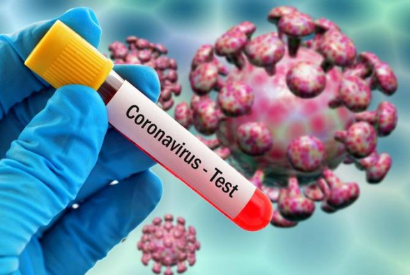 За сутки в Армении выявлено 592 новых случая коронавируса, скончались еще 42 человека