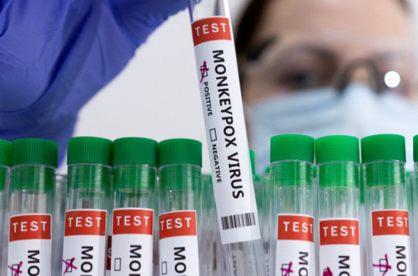 Ռուսաստանը կապիկի ծաղիկի թեստեր է նվիրաբերել Հայաստանին ու ԱՊՀ մի քանի այլ երկրի