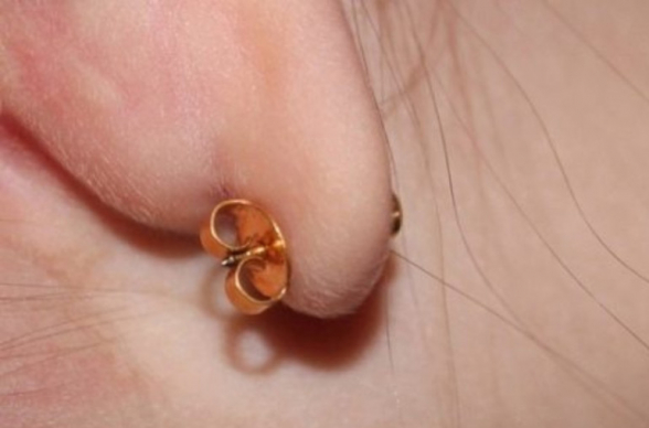 Ռուսաստանում մայրը փրկարարների է կանչել դստեր ականջից ականջօղը հանելու համար