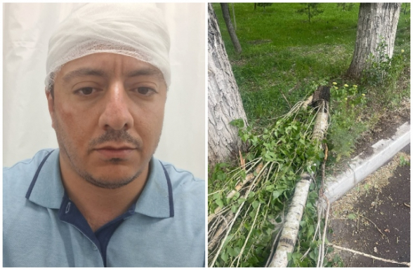 Արտակարգ դեպք Քանաքեռում. այգում ծառի մի հատված պոկվել և ընկել է քաղաքացու գլխին